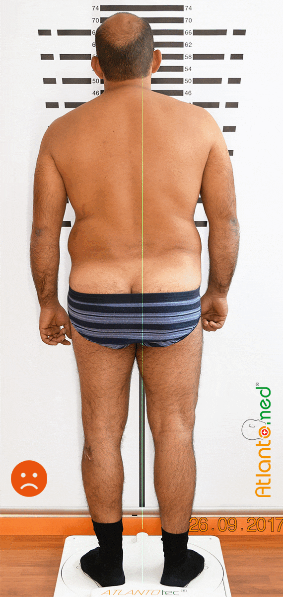 Amélioration de la posture après correction de l'Atlas Amélioration de la posture après la correction de l'Atlas