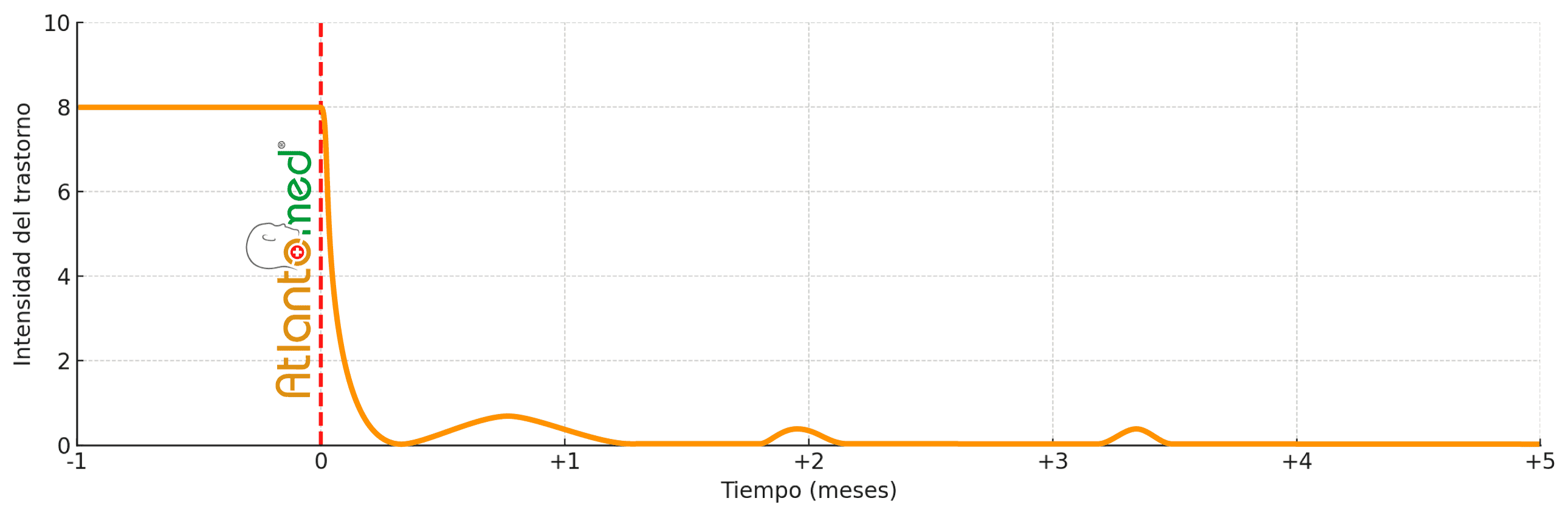 Evolución de la migraña tras AtlantoMed