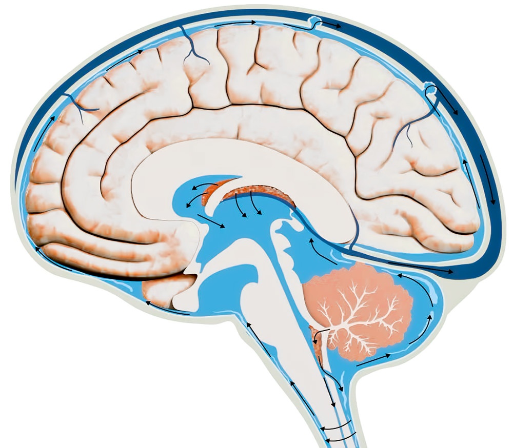 Disturbi del liquido cerebrospinale: conseguenze dellAtlante disallineato  - ATLANTOMED