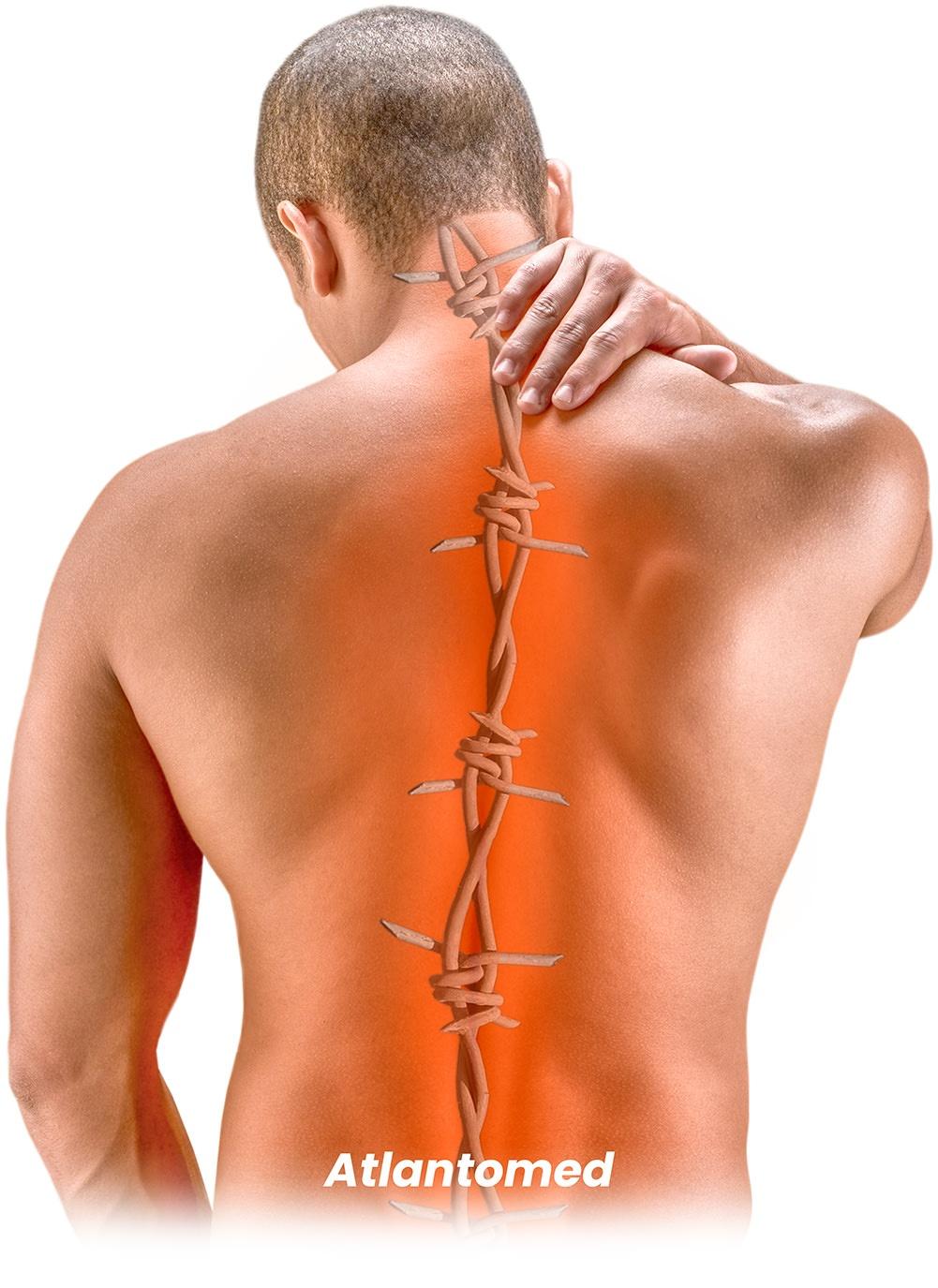 Mann mit Rückenschmerzen und Muskelverspannungen