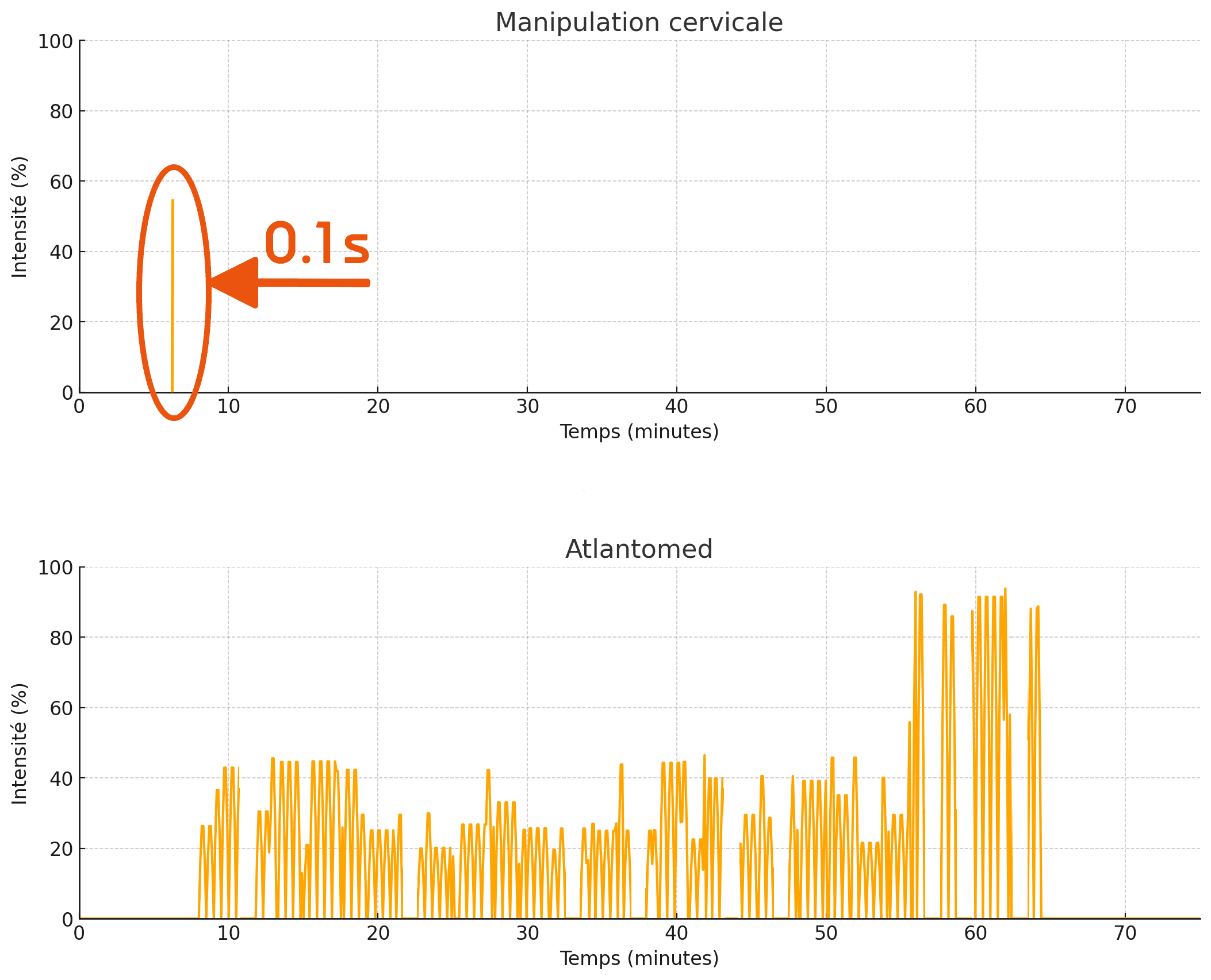 Graphique de la durée d'une manipulation vs traitement Atlantomed