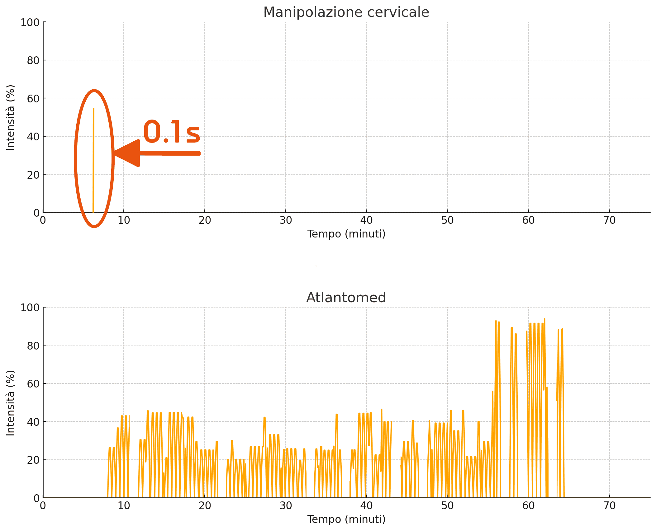 Grafico della durata di una manipolazione vs trattamento Atlantomed