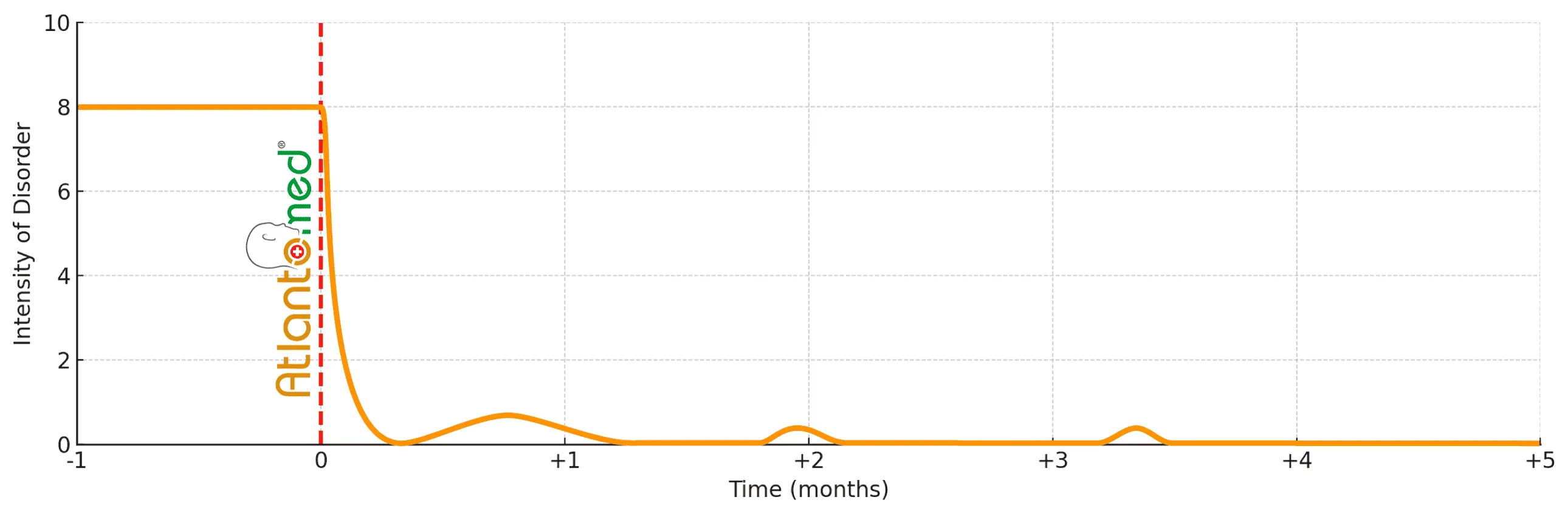 Migraine Progression After Atlantomed